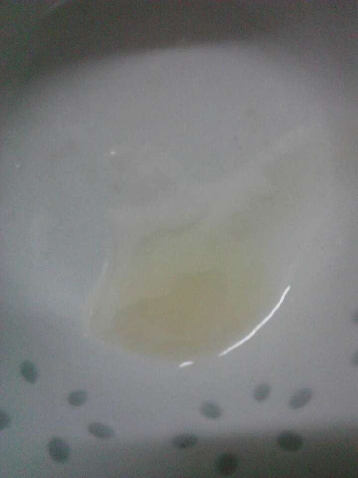 福州67岁老人做赠卵试管婴儿--60岁妇女做赠卵试管婴儿的状况