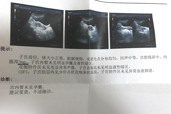 供卵试管婴儿是否在商业保险范围内？