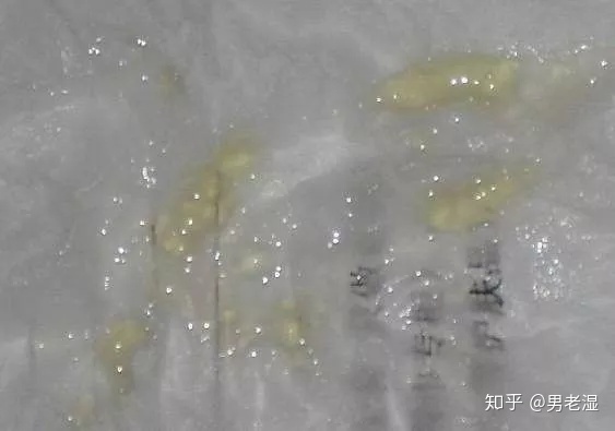 借卵试管婴儿促排卵期间吃榴莲好吗-借卵试管婴儿取卵后吃榴莲好吗