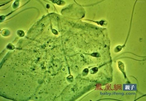 供卵试管代生代怀一代精子和卵子没有结合