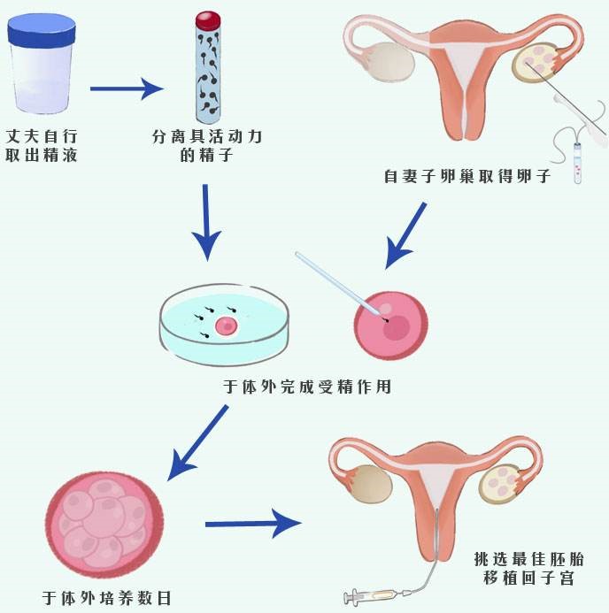 借卵子做供卵助孕供卵试管行吗