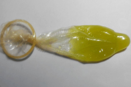 福州九洲医院赠卵试管婴儿成功率
