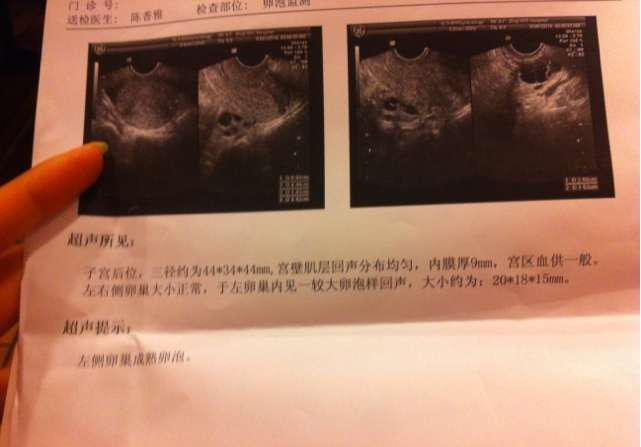 福州试管婴儿哪个医院好