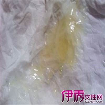 全世界试管代怀费用多少费用技术最先进的国家是哪个