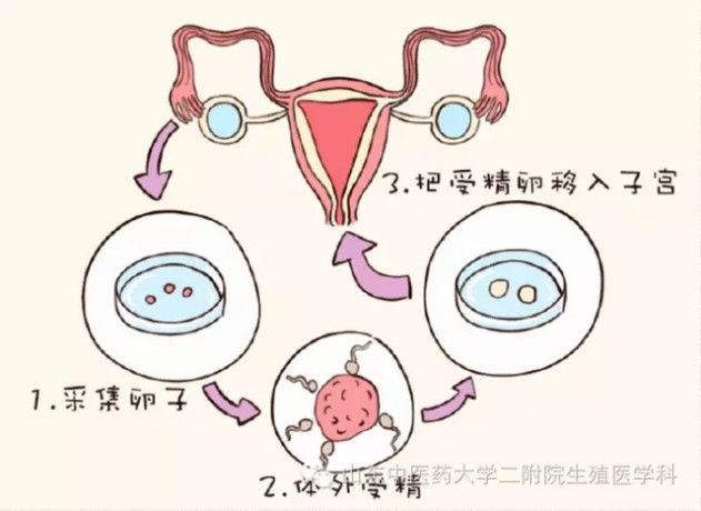 试管代怀哪里有吗孩子寿命+生了代怀生子的医院后悔了
