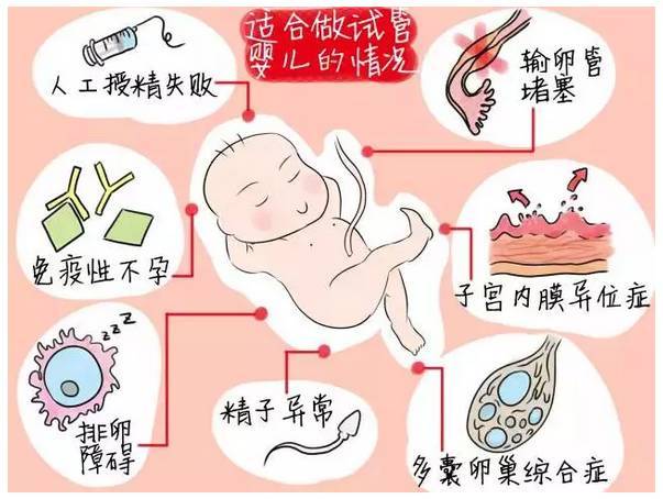 2024年生育三胞胎国家有补助吗+